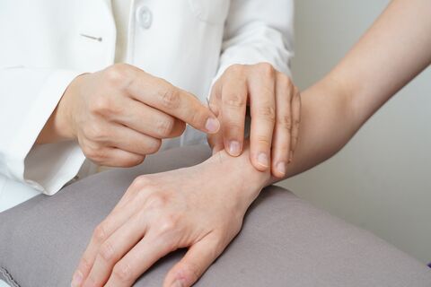 Physiotherapeut führt Dry Needling an der Hand zur Lösung muskulärer Verspannungen durch.