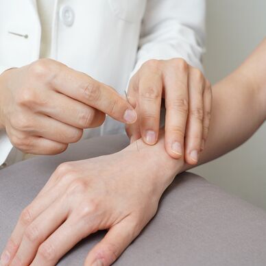 Physiotherapeut führt Dry Needling an der Hand zur Lösung muskulärer Verspannungen durch.